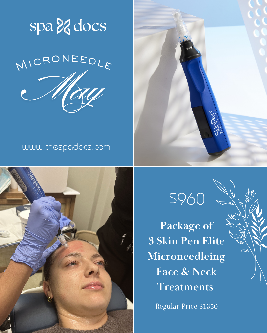 Microneedle May
