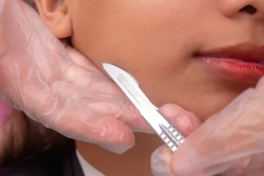 dermplaning