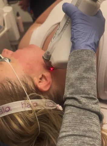 halo-laser-treatment