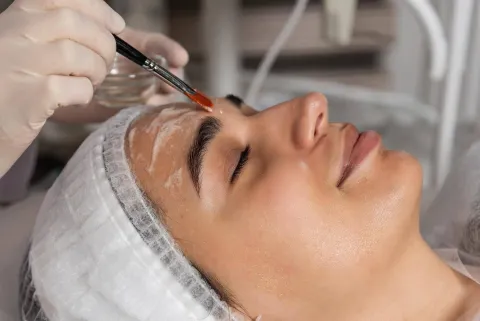 perfect-derma-peel