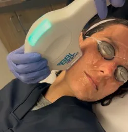 broad-band-light-treatment