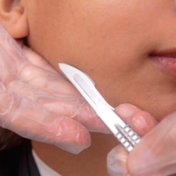 dermplaning