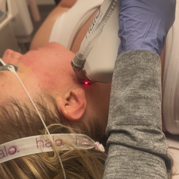 halo-laser-treatment