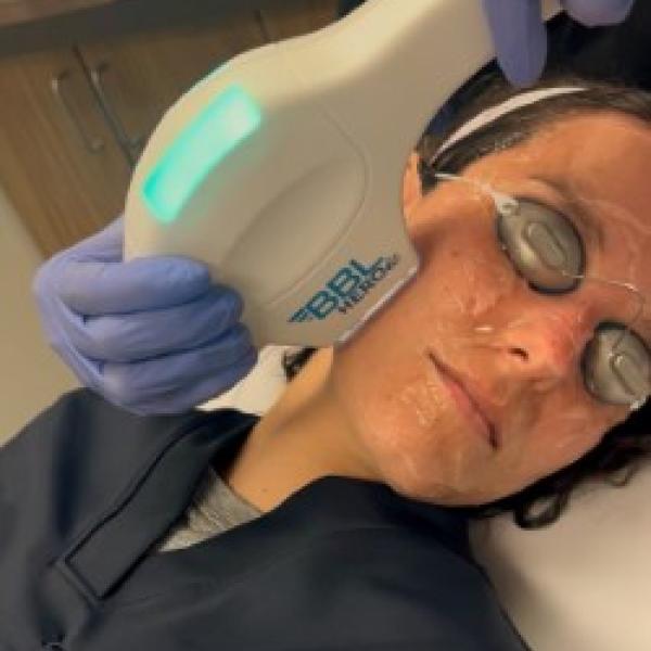 broad-band-light-treatment